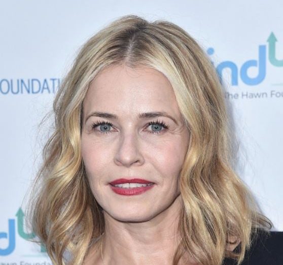 Chelsea Handler Cosmetic Surgery