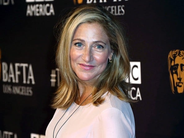 Edie Falco Plastic Surgery Procedures