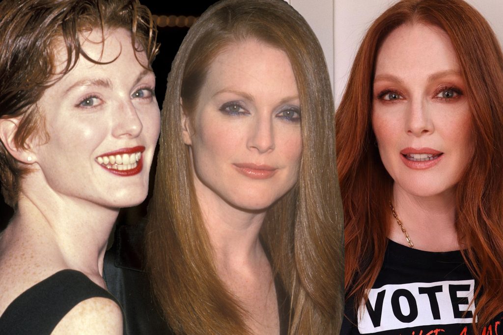 Julianne Moore Plastic Surgery