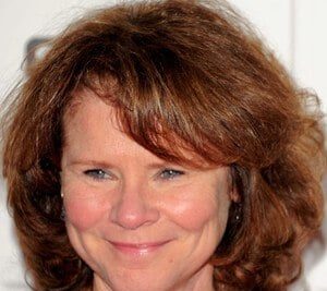 Imelda Staunton Plastic Surgery