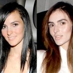 Ali Lohan Cosmetic Surgery