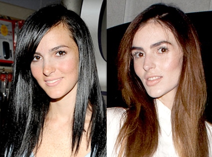 Ali Lohan Cosmetic Surgery