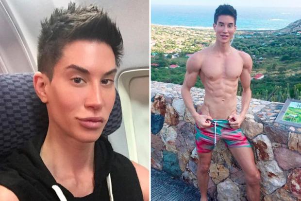 Justin Jedlica Cosmetic Surgery Body