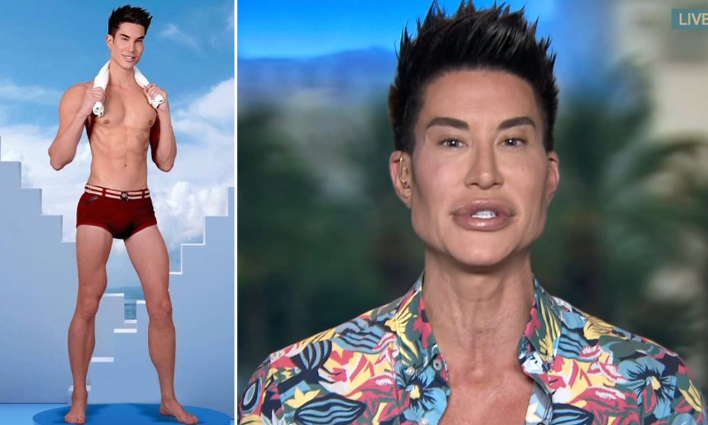 Justin Jedlica Plastic Surgery