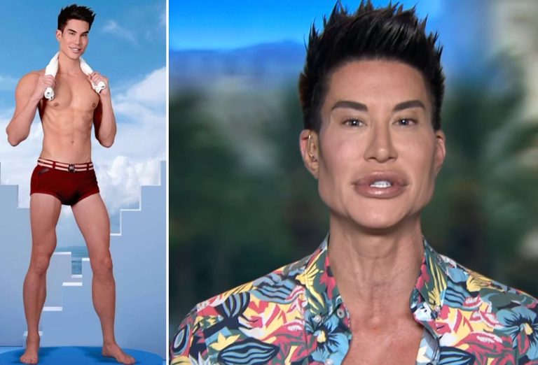 Justin Jedlica Plastic Surgery