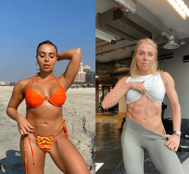 Gabby Allen Plastic Surgery Body