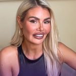 Chloe Sims Plastic Surgery Procedures