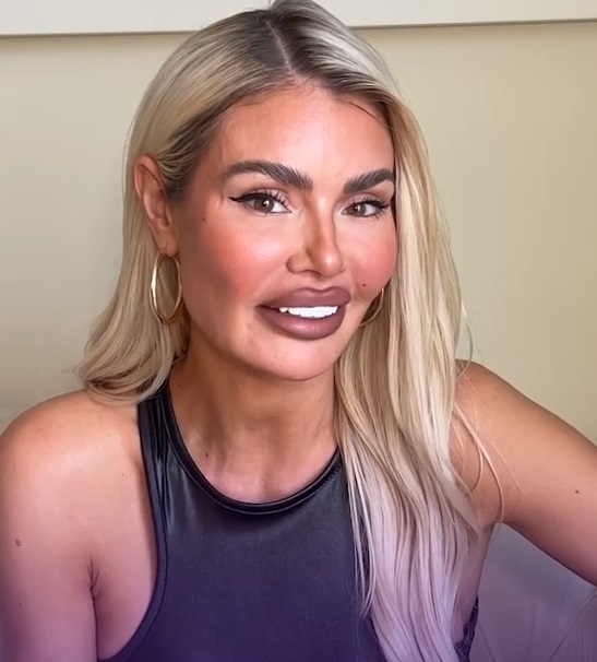 Chloe Sims Plastic Surgery Procedures