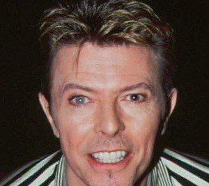 David Bowie Plastic Surgery