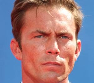 Desmond Harrington Plastic Surgery