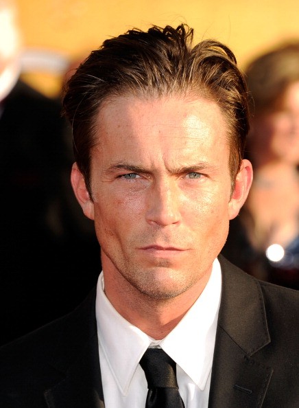 Desmond Harrington Plastic Surgery Face