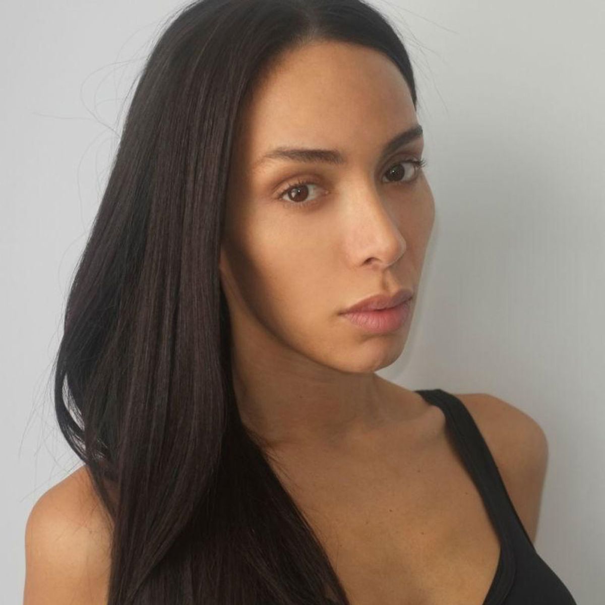 Did Ines Rau Get Plastic Surgery? - Plastic Surgery Talks