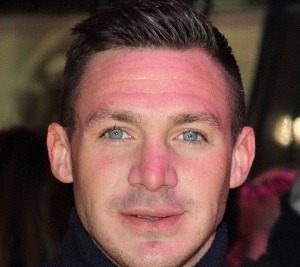 Kirk Norcross Nose Job