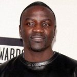Akon Hair Transplant