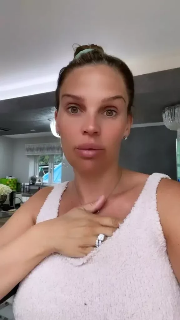 Danielle Lloyd Plastic Surgery Face