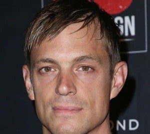 Joel Kinnaman Plastic Surgery