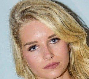 Lottie Moss Plastic Surgery Procedures