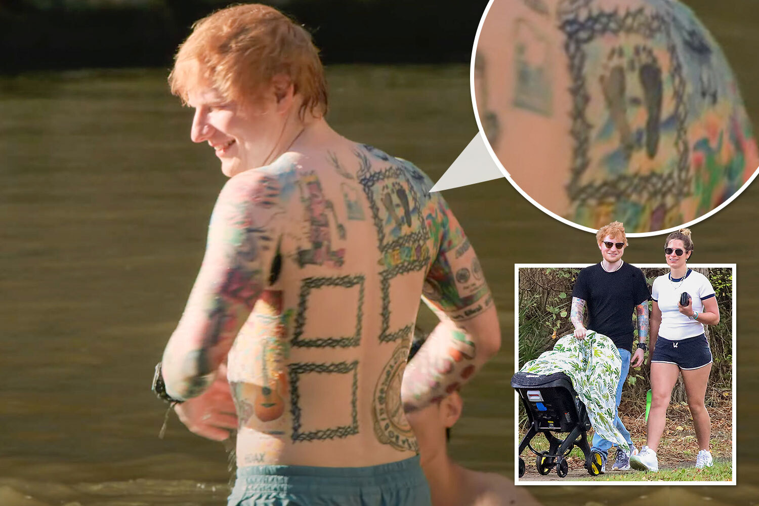 Ed Sheeran's Stance on Plastic Surgery